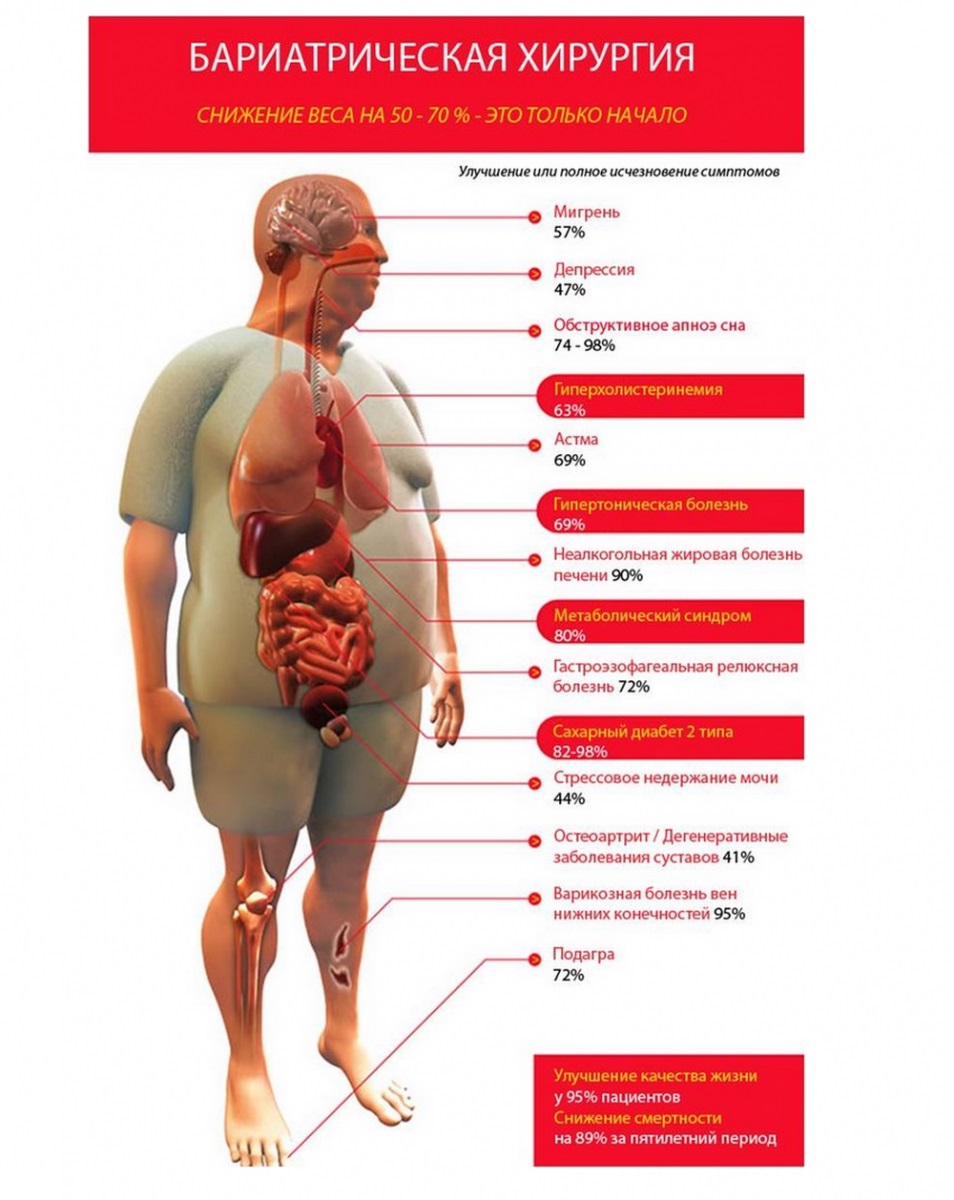 Секреты стройного тела лишний вес от болезни